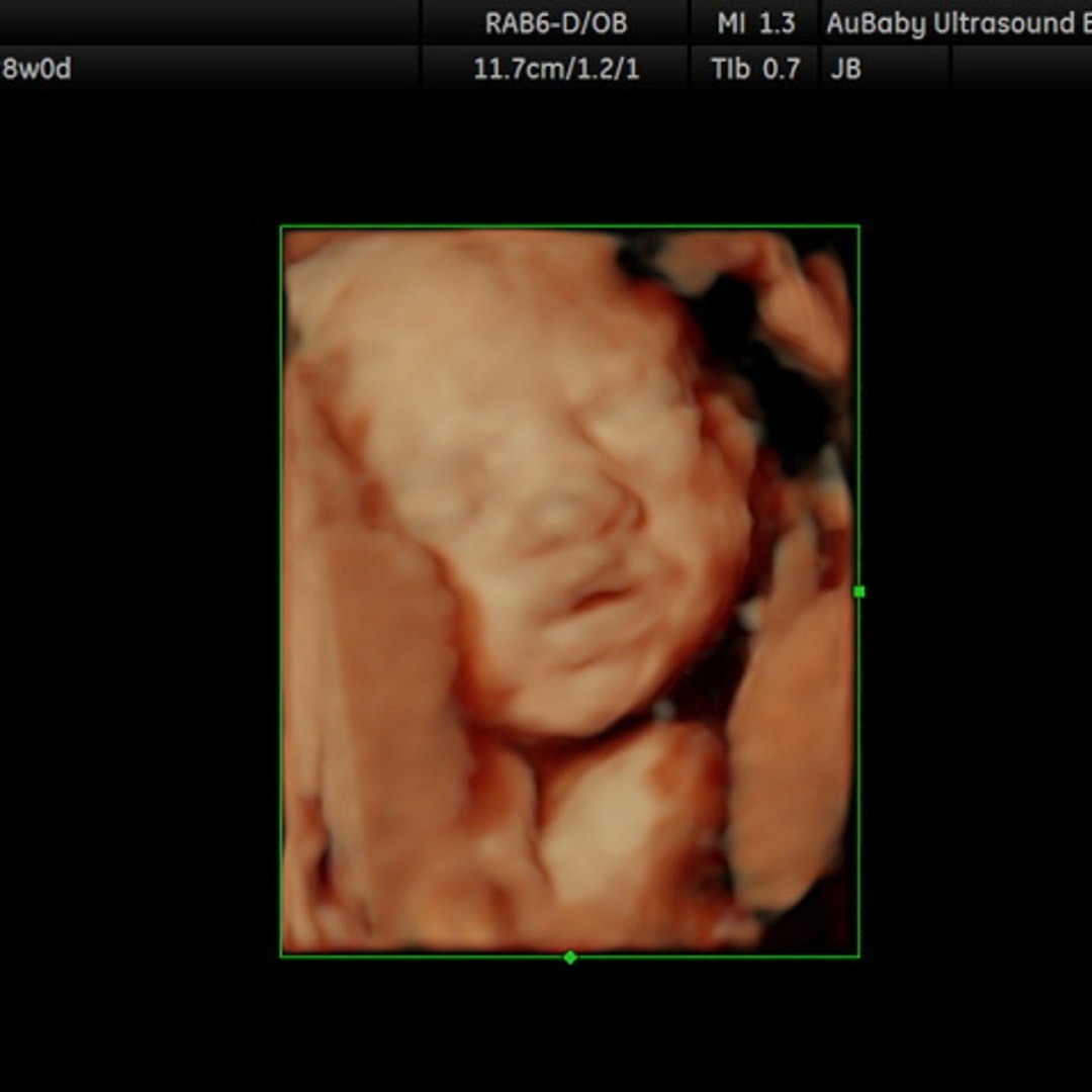 Photo shared by Karley for their Babylist baby registry.