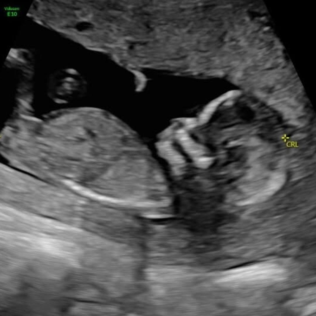 Photo shared by Bronwyn for their Babylist baby registry.