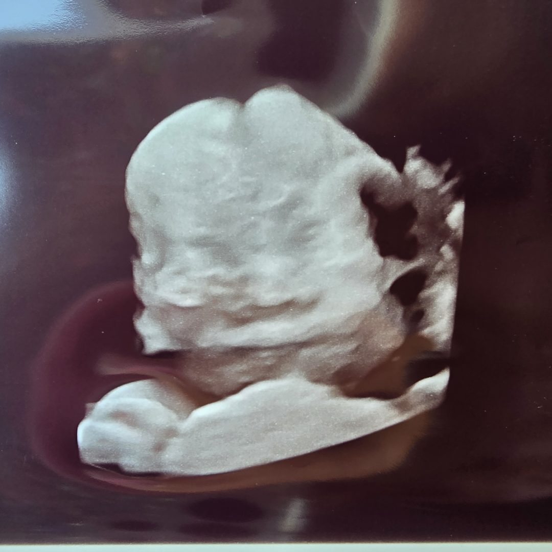 Photo shared by Danielle for their Babylist baby registry.