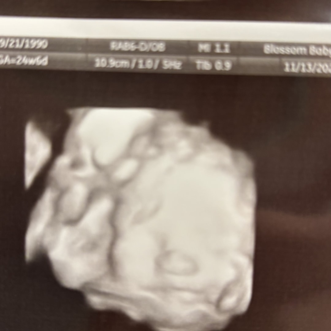 Photo shared by Nikki for their Babylist baby registry.