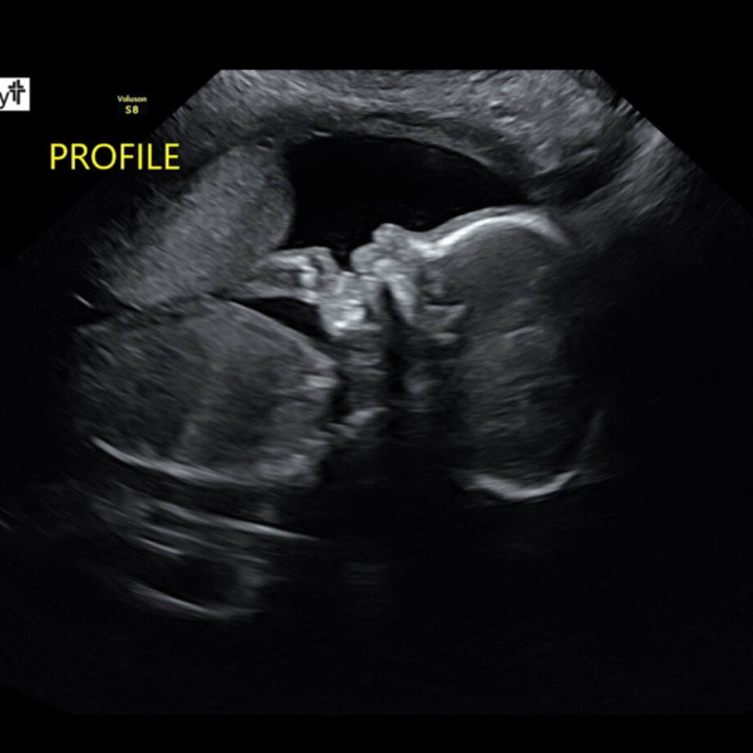 Photo shared by Autumn for their Babylist baby registry.