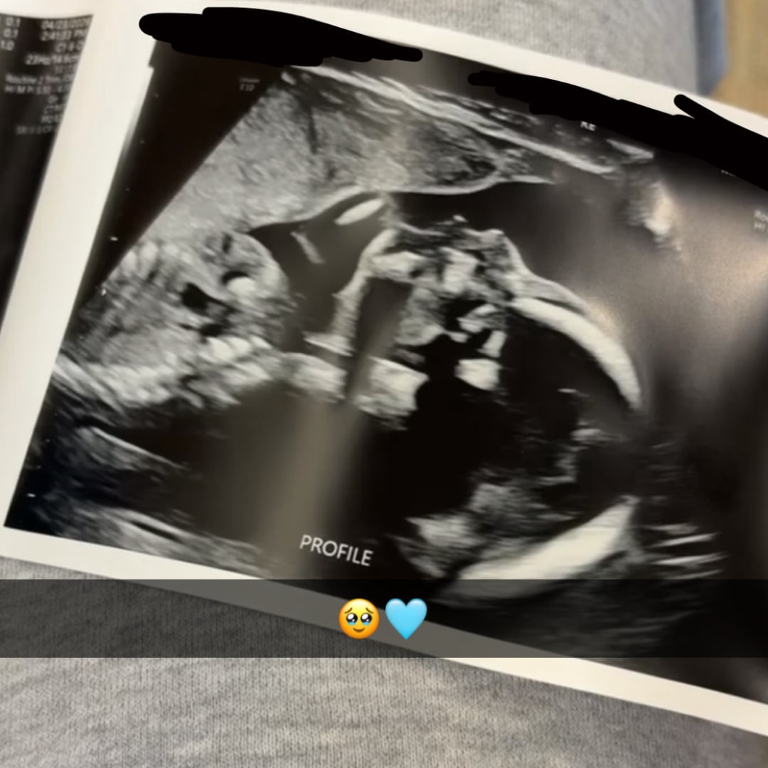 Photo shared by Cheyenne for their Babylist baby registry.