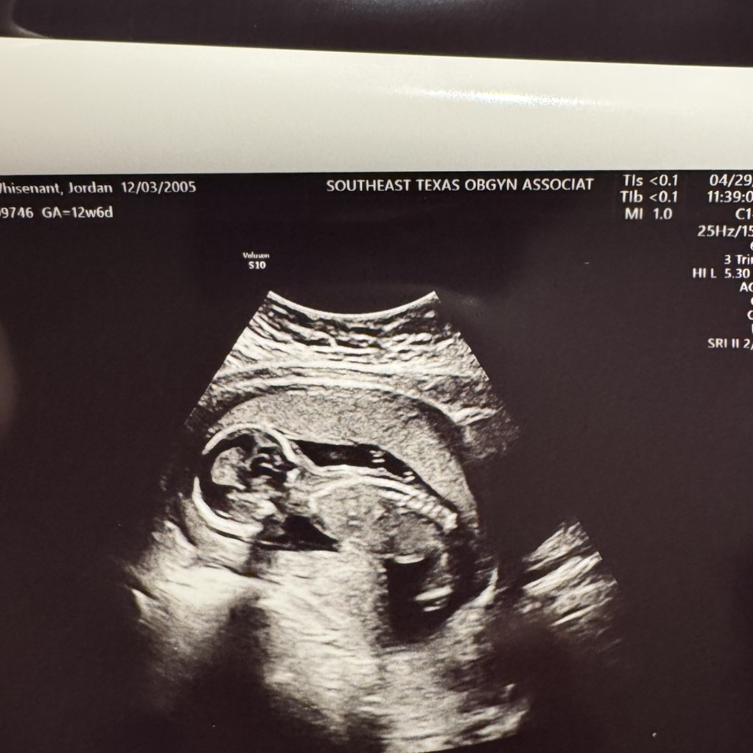 Photo shared by Jordan for their Babylist baby registry.
