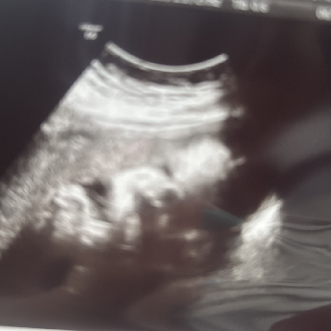 Photo shared by Callie for their Babylist baby registry.