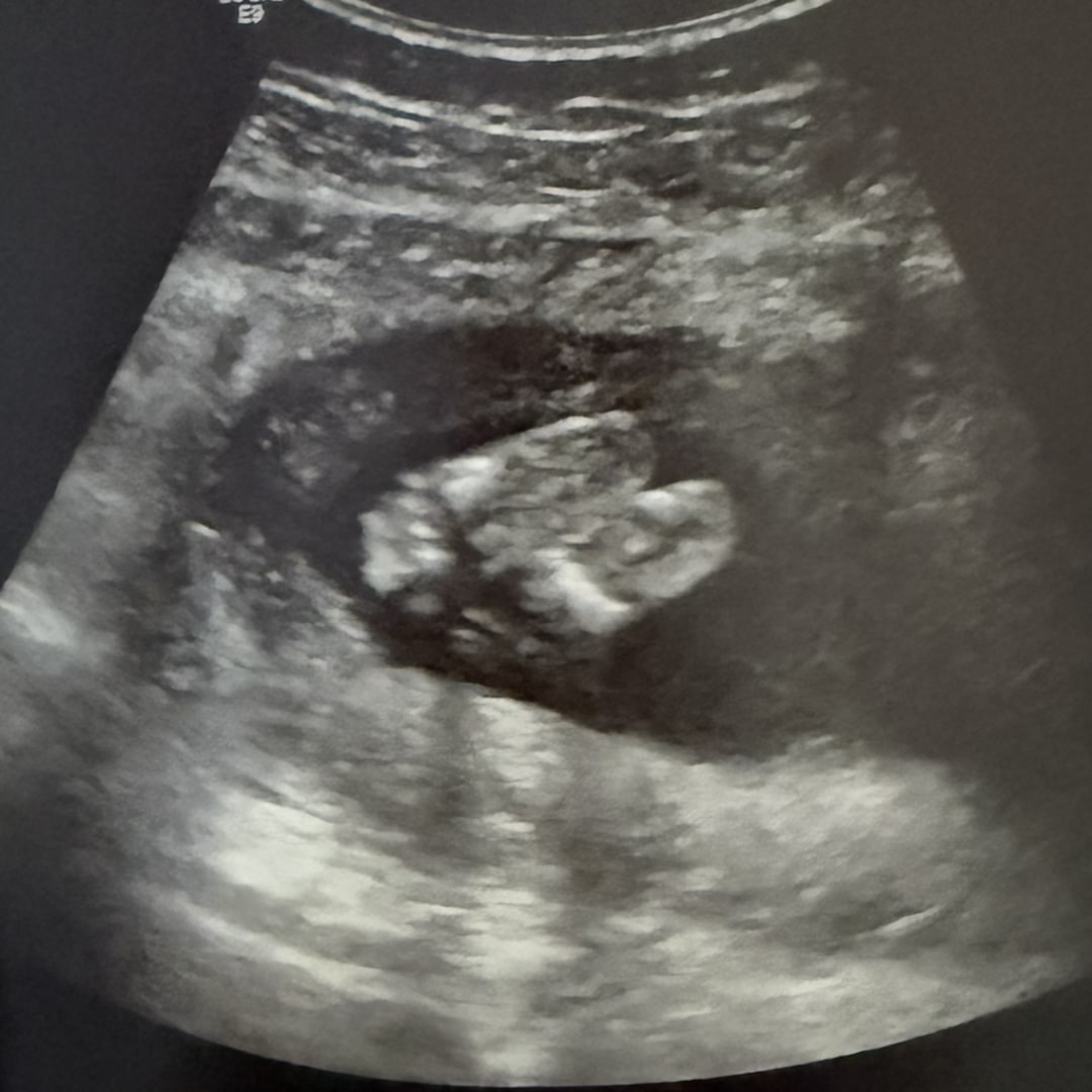 Photo shared by Michelle for their Babylist baby registry.