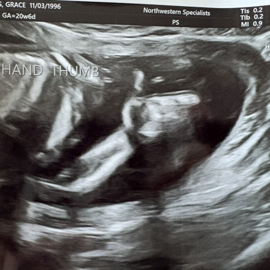 Photo shared by Grace for their Babylist baby registry.