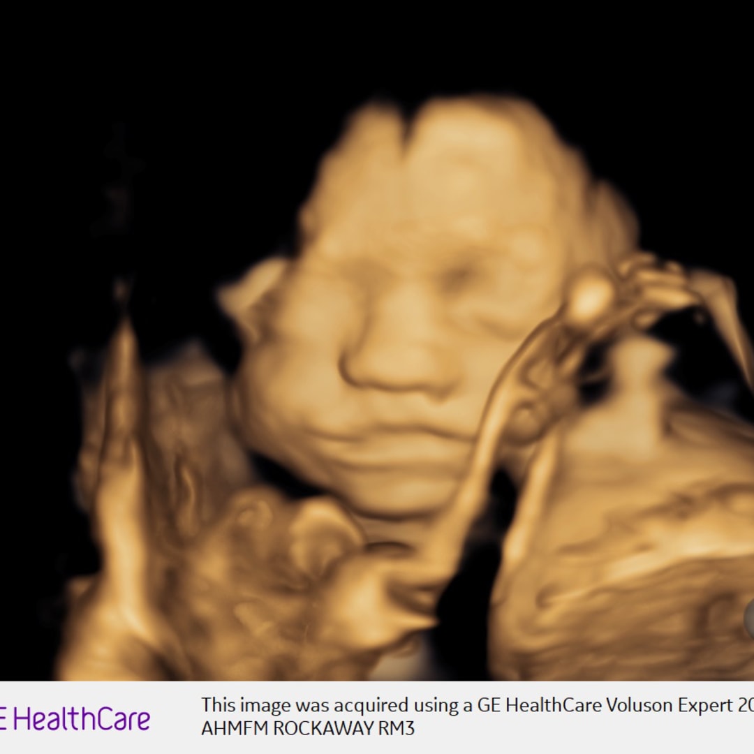 Photo shared by Elexa for their Babylist baby registry.
