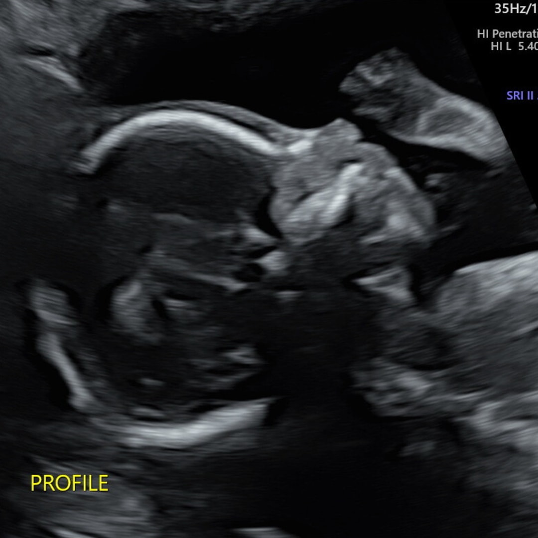 Photo shared by Vanessa for their Babylist baby registry.