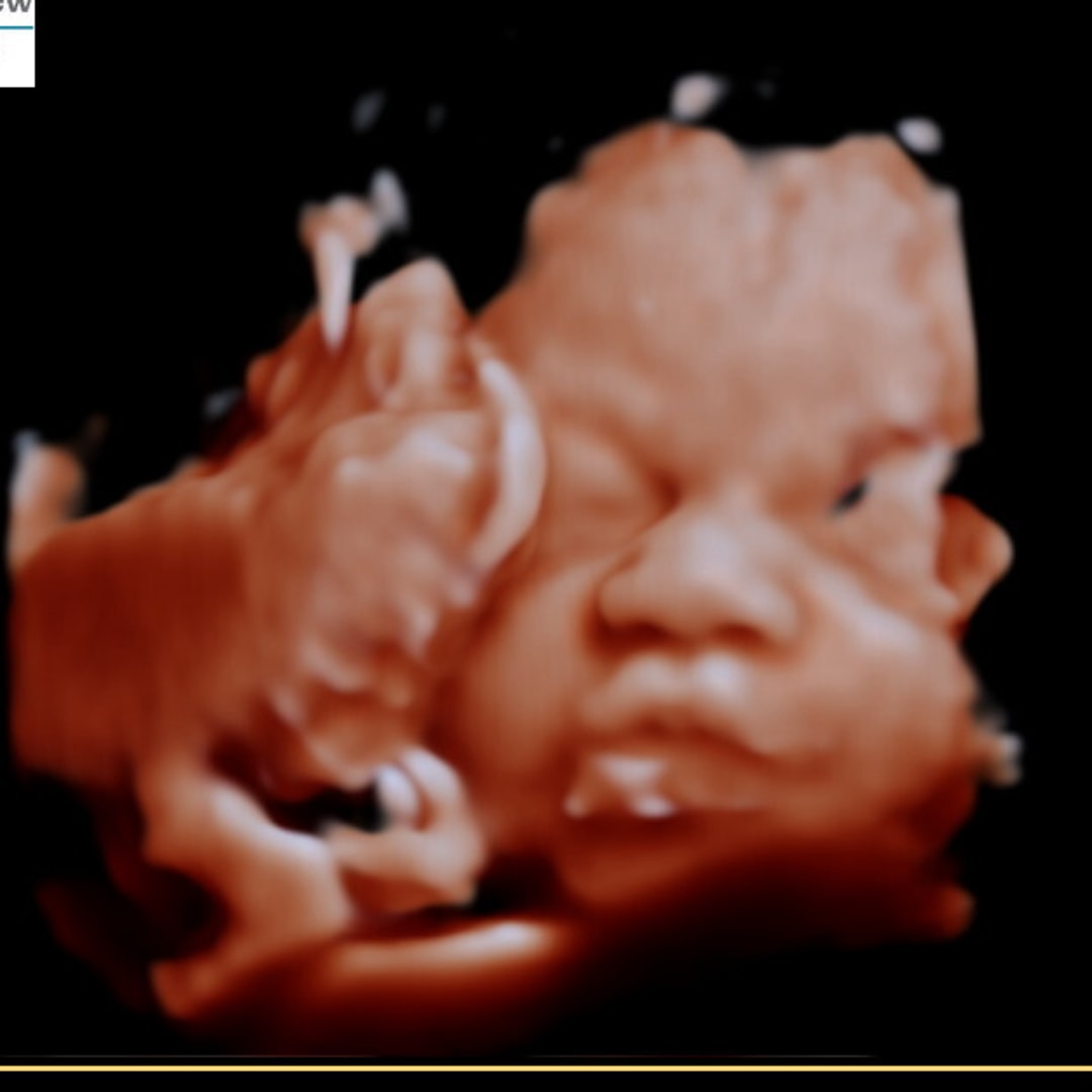 Photo shared by Arial for their Babylist baby registry.