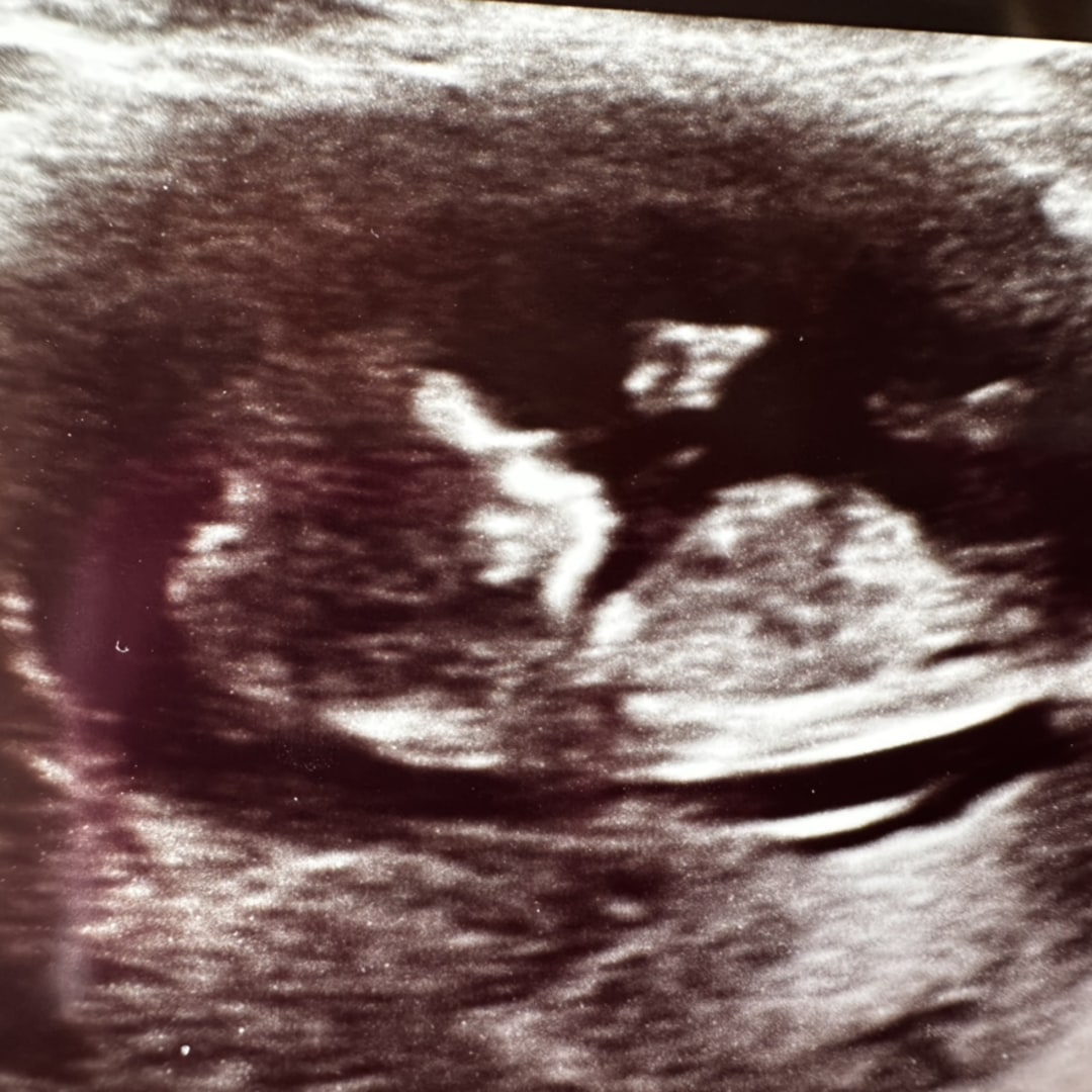 Photo shared by Darcy for their Babylist baby registry.