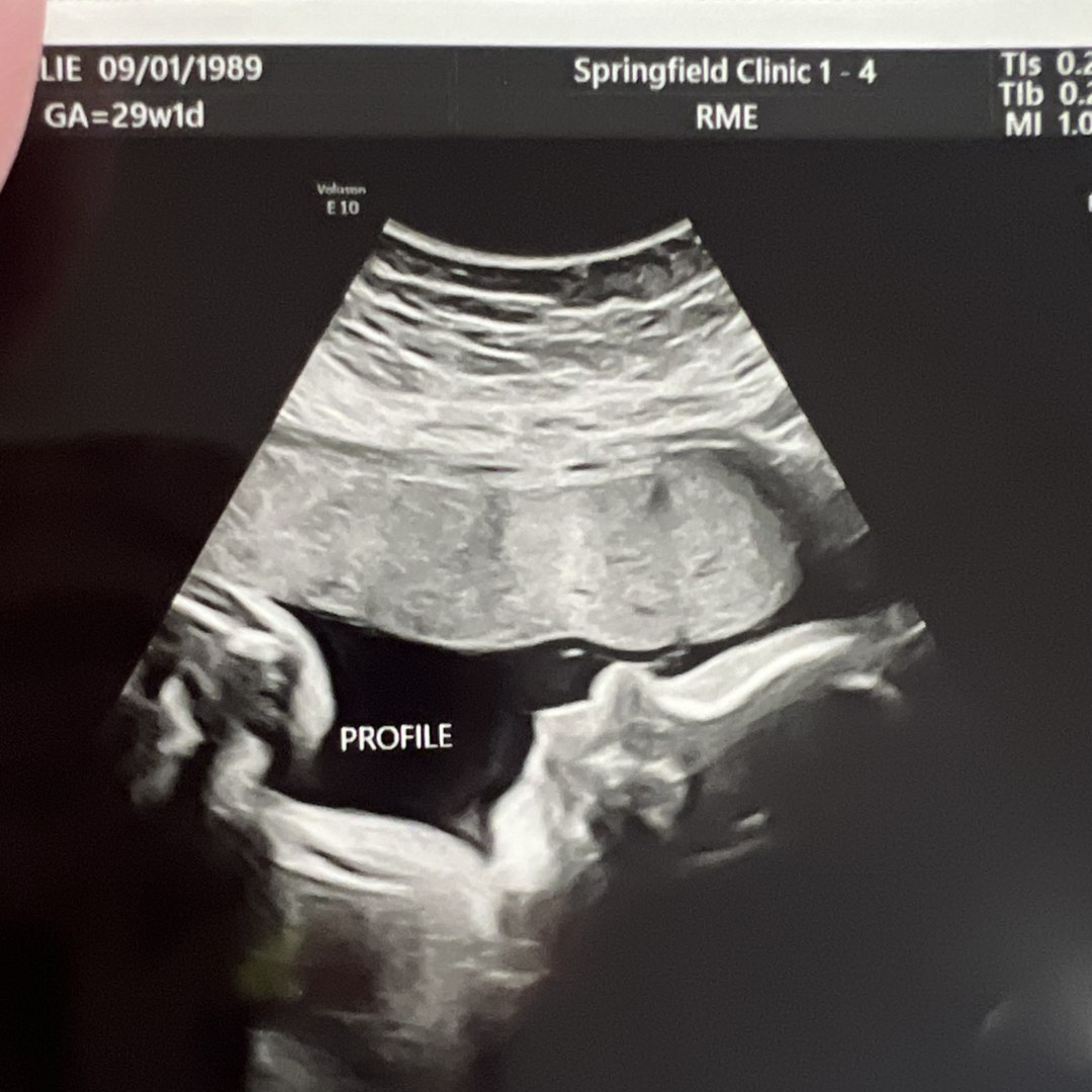 Photo shared by Callie for their Babylist baby registry.