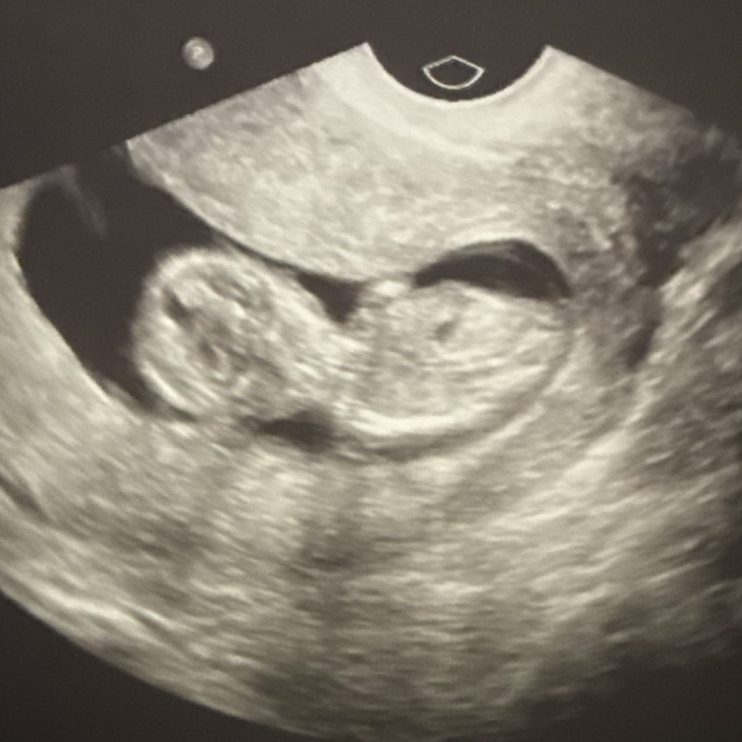 Photo shared by Megen for their Babylist baby registry.
