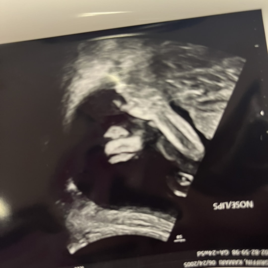 Photo shared by Kamari for their Babylist baby registry.