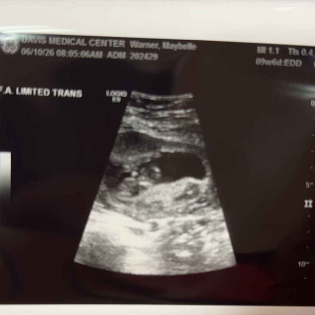 Photo shared by Maybelle for their Babylist baby registry.