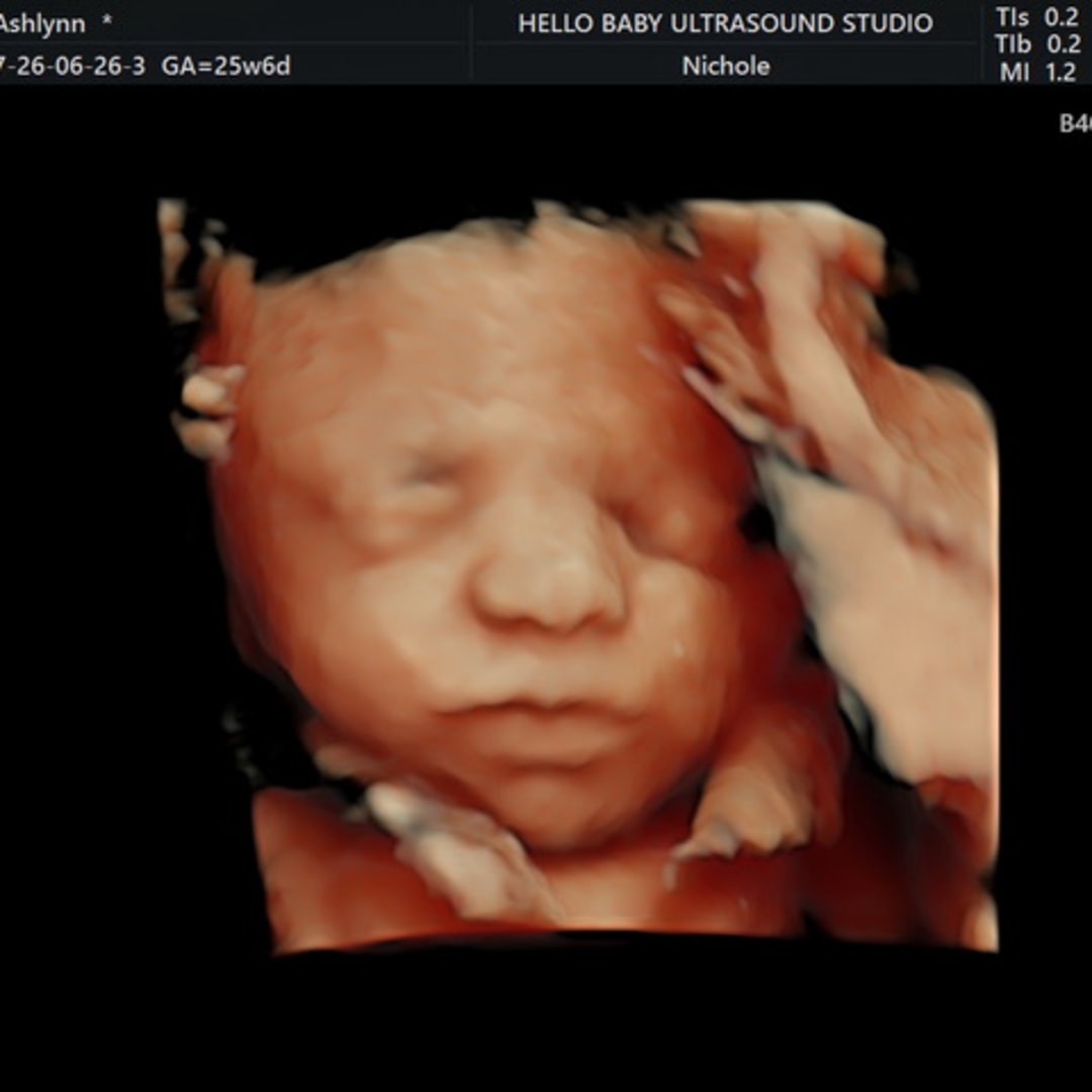 Photo shared by Ashlynn for their Babylist baby registry.