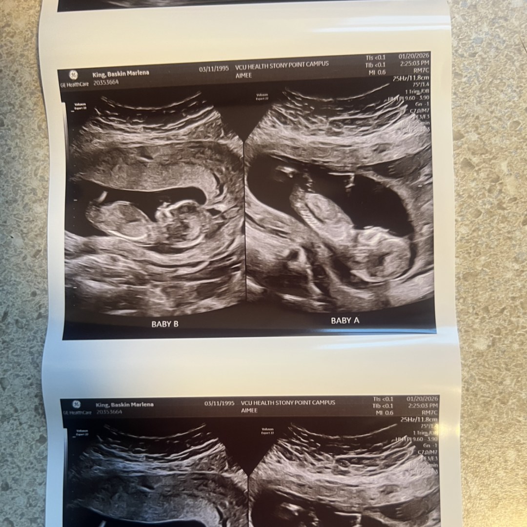 Photo shared by Marlena & Marcus for their Babylist baby registry.