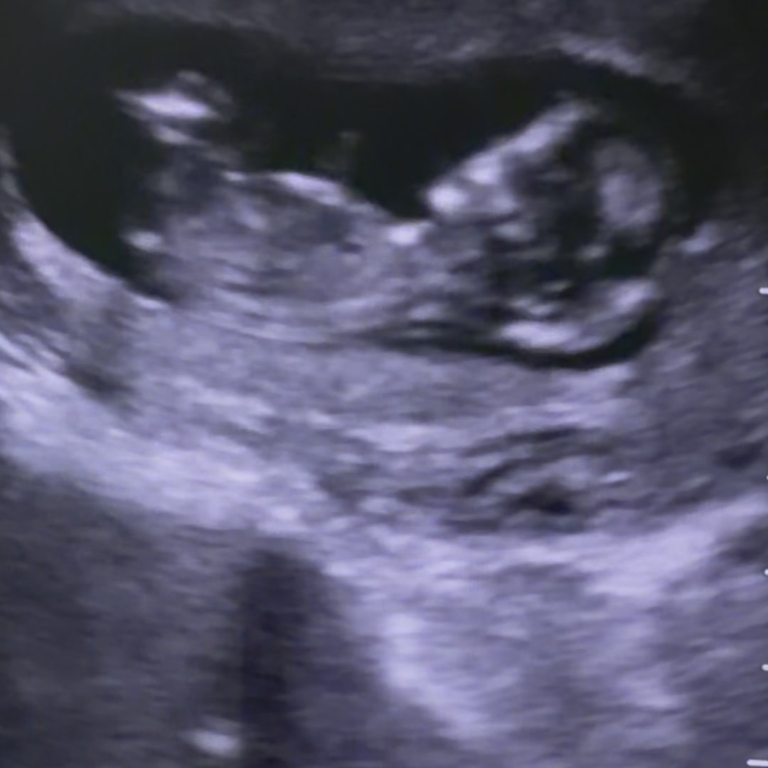 Photo shared by Marissa for their Babylist baby registry.