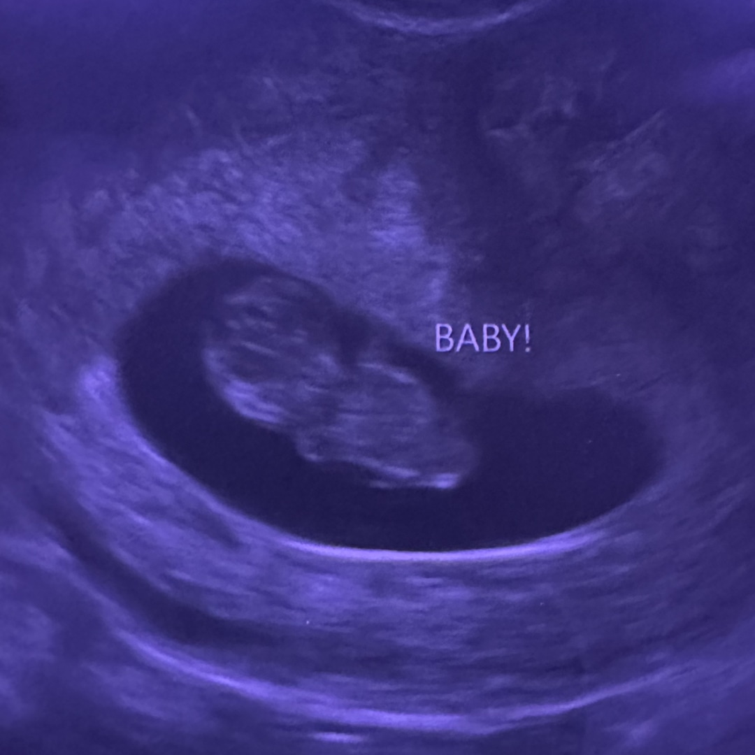 Photo shared by Aerie for their Babylist baby registry.