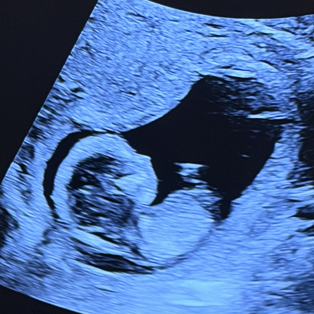 Photo shared by Kaylee for their Babylist baby registry.