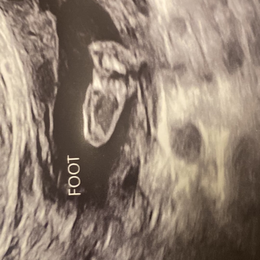Photo shared by Nayeli for their Babylist baby registry.