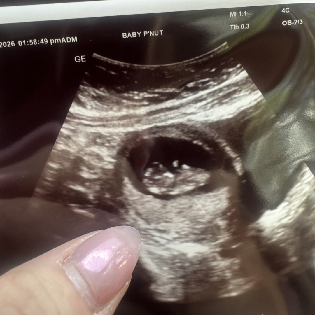 Photo shared by Grace for their Babylist baby registry.