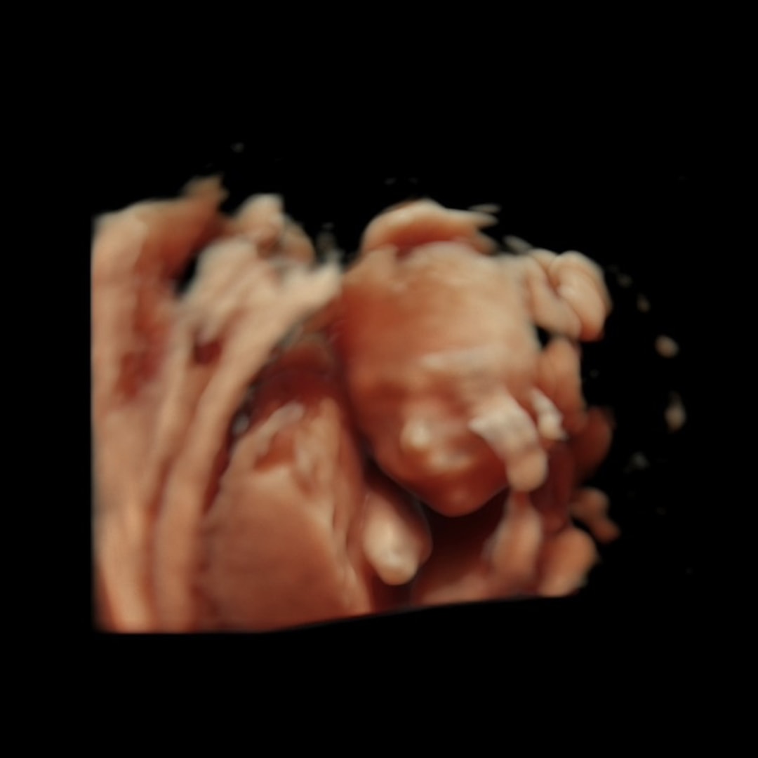 Photo shared by Erika for their Babylist baby registry.