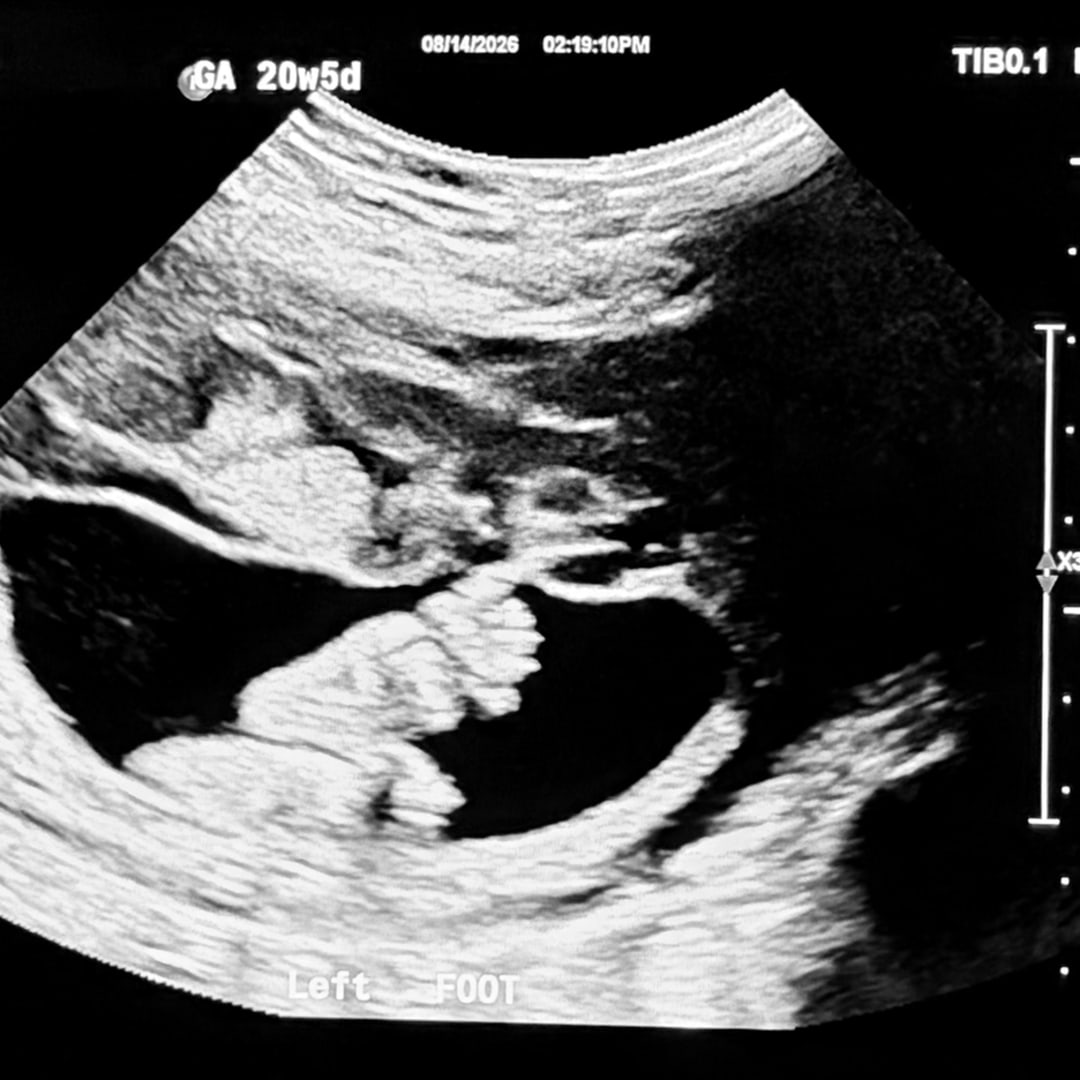 Photo shared by Izabella for their Babylist baby registry.