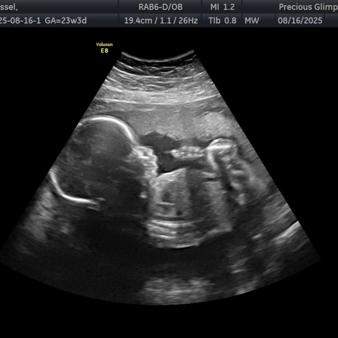 Photo shared by Dacie for their Babylist baby registry.