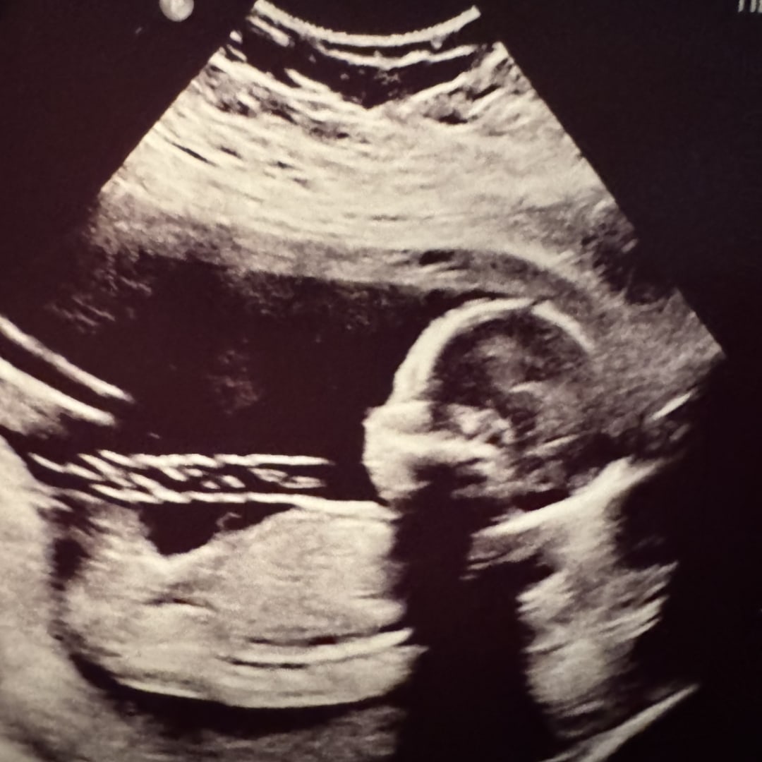 Photo shared by Ashley for their Babylist baby registry.