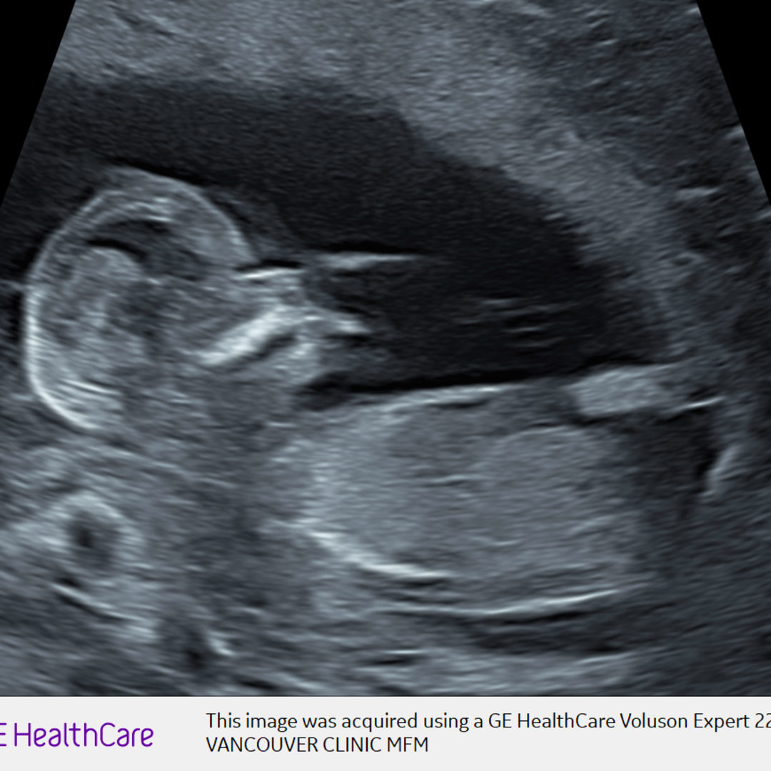 Photo shared by Laura for their Babylist baby registry.