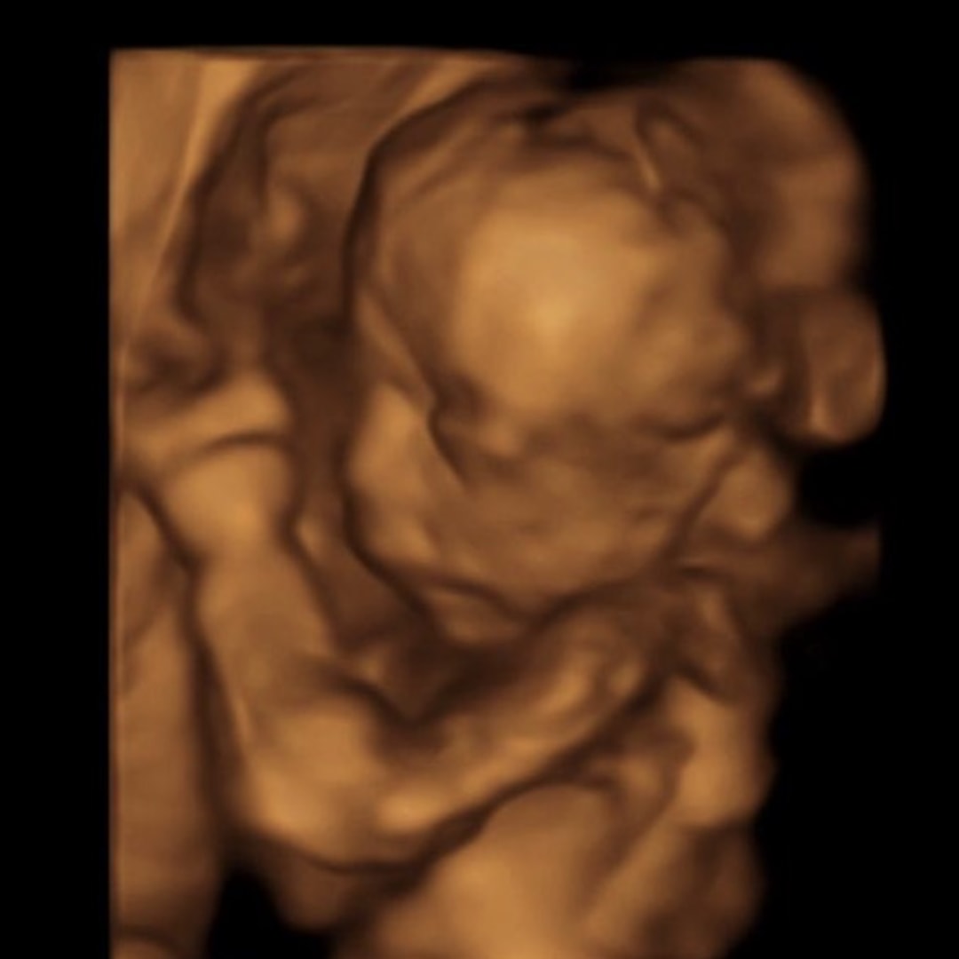 Photo shared by Charlie for their Babylist baby registry.