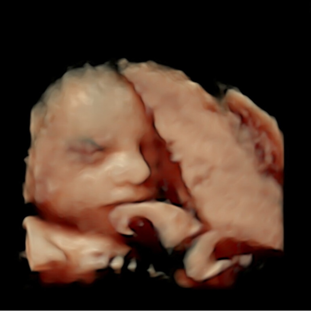 Photo shared by Theresa for their Babylist baby registry.