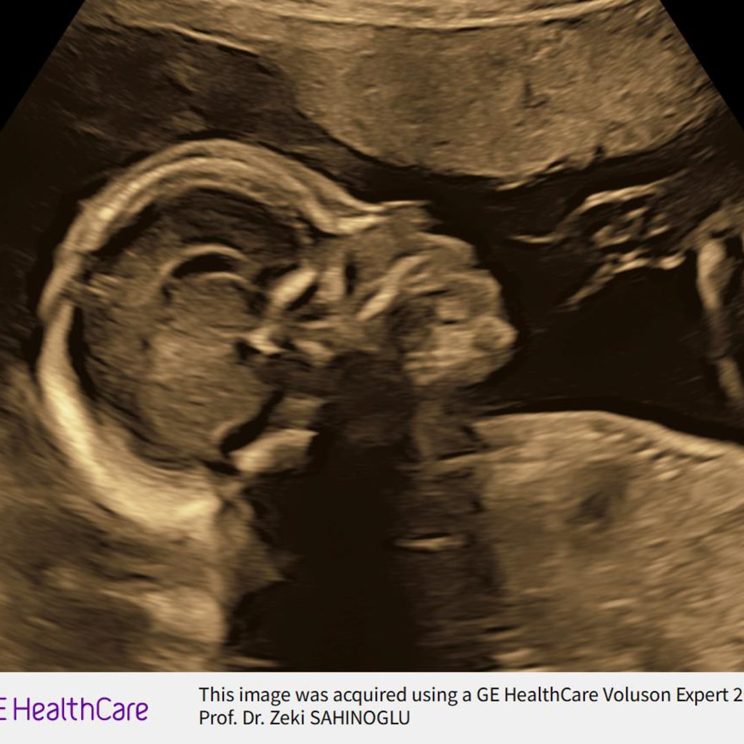 Photo shared by Alexa for their Babylist baby registry.