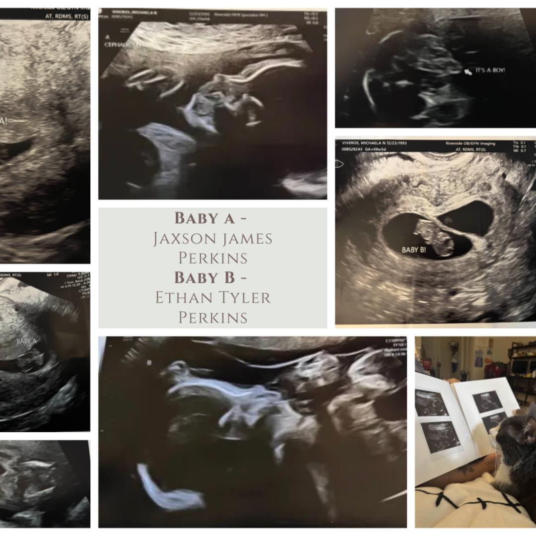 Photo shared by Michaela for their Babylist baby registry.