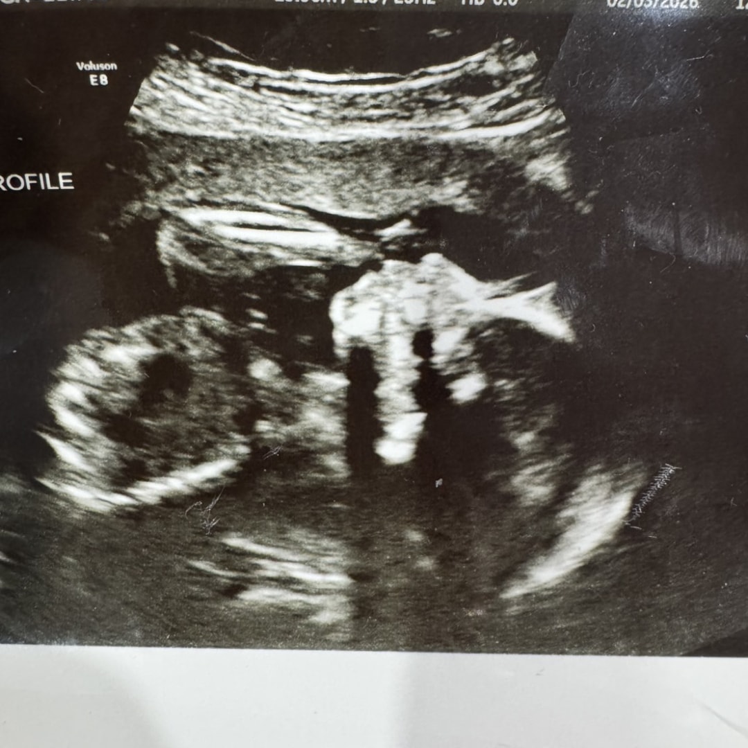 Photo shared by NV for their Babylist baby registry.