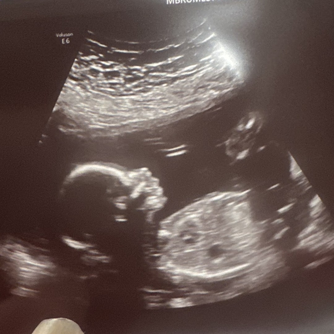 Photo shared by Elizabeth for their Babylist baby registry.