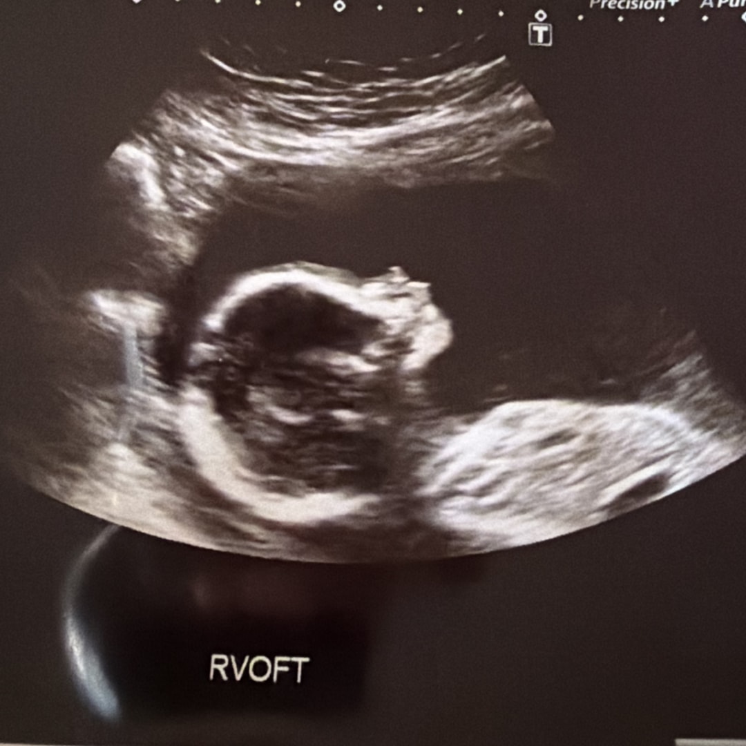 Photo shared by Dallas for their Babylist baby registry.