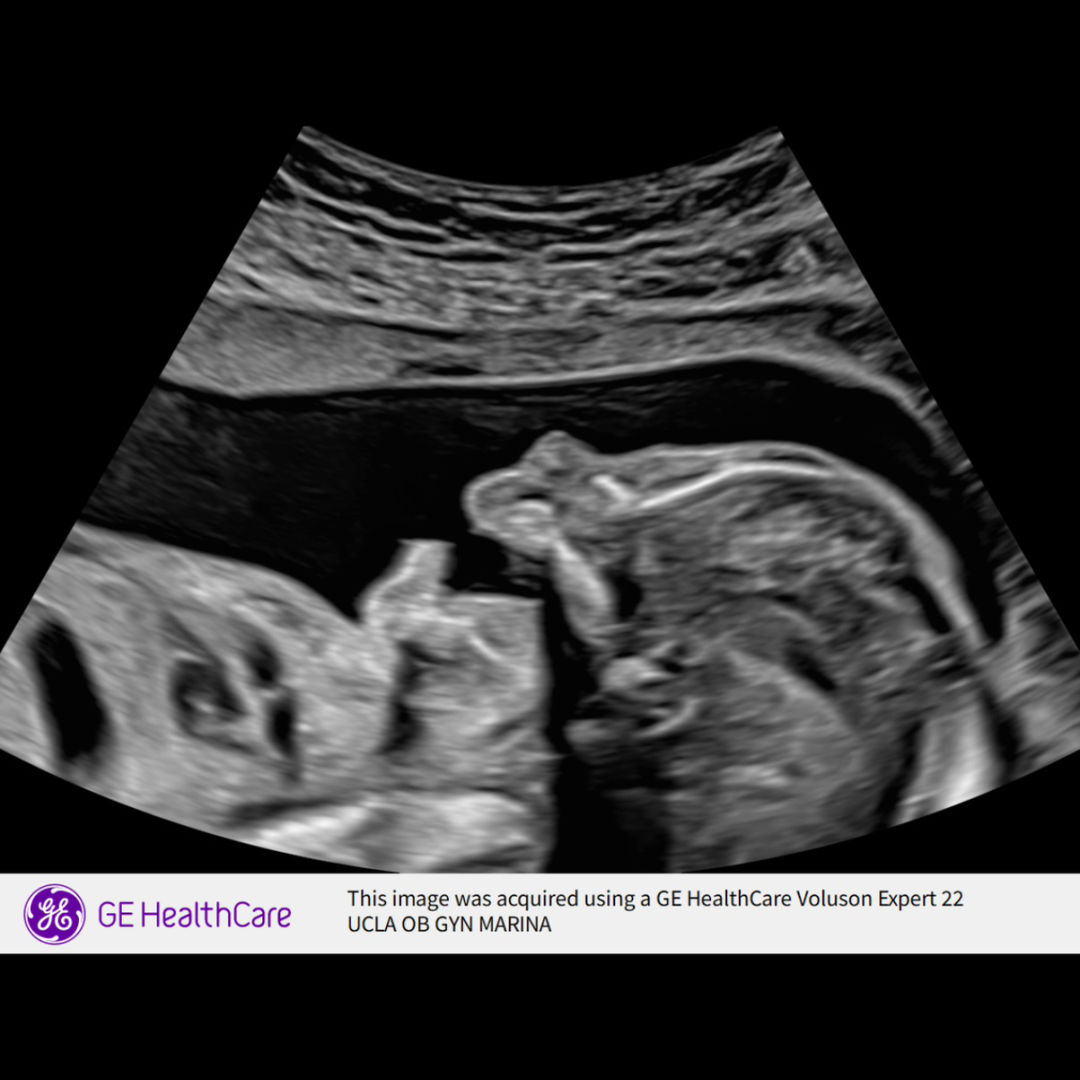 Photo shared by Lindsey for their Babylist baby registry.