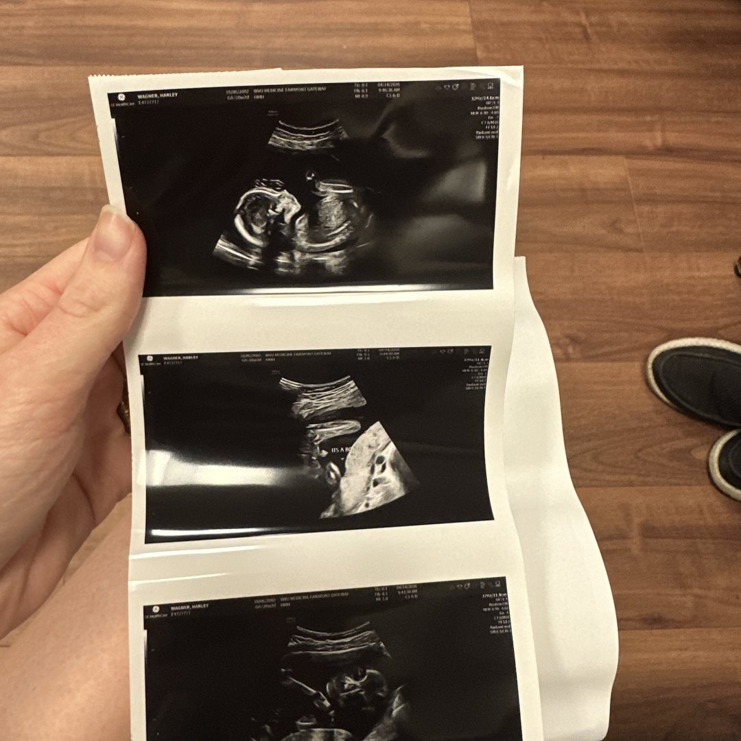 Photo shared by Harley for their Babylist baby registry.