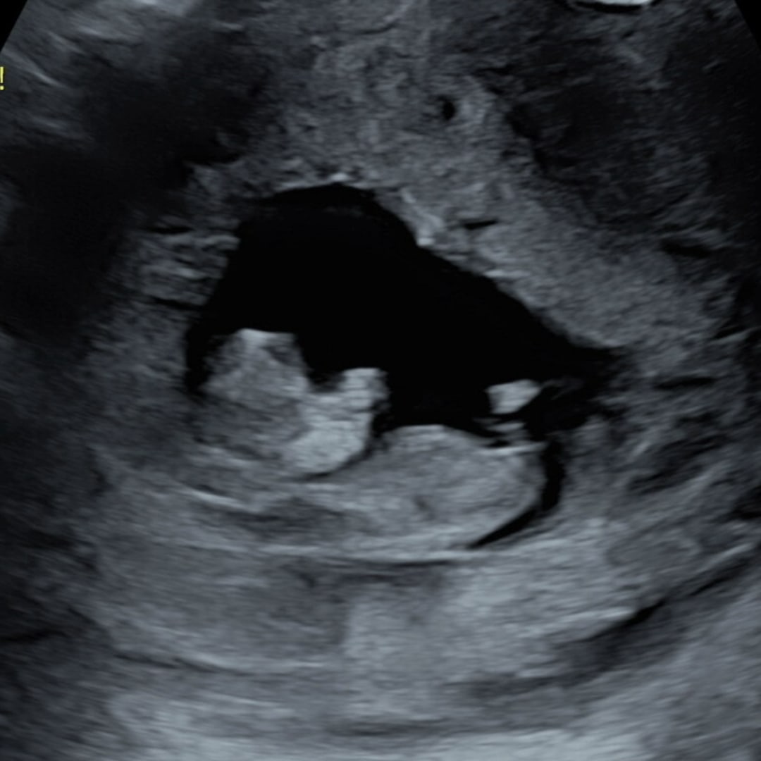 Photo shared by Chelsea for their Babylist baby registry.