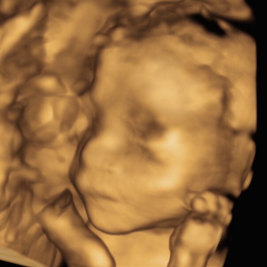 Photo shared by Ashley for their Babylist baby registry.
