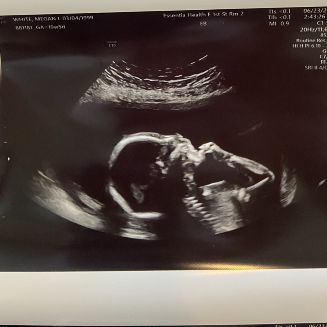 Photo shared by Megan for their Babylist baby registry.