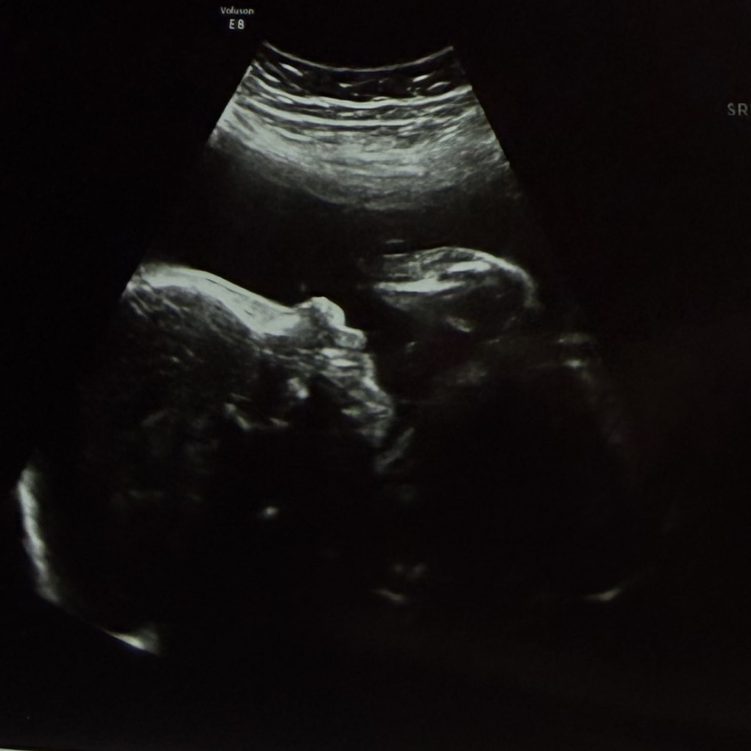 Photo shared by Dafne for their Babylist baby registry.