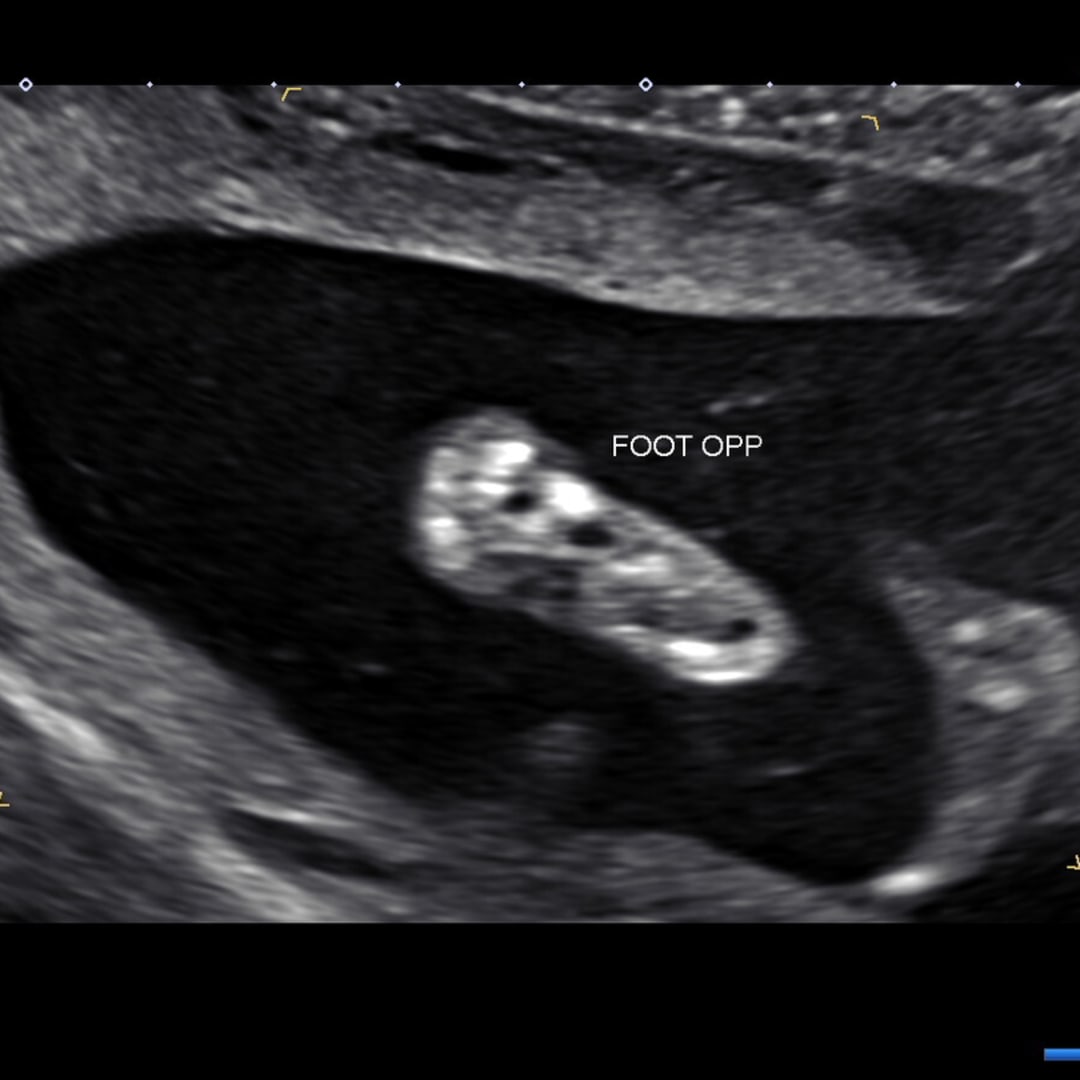 Photo shared by Jesa for their Babylist baby registry.