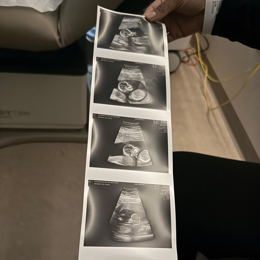 Photo shared by Flor Cristina for their Babylist baby registry.