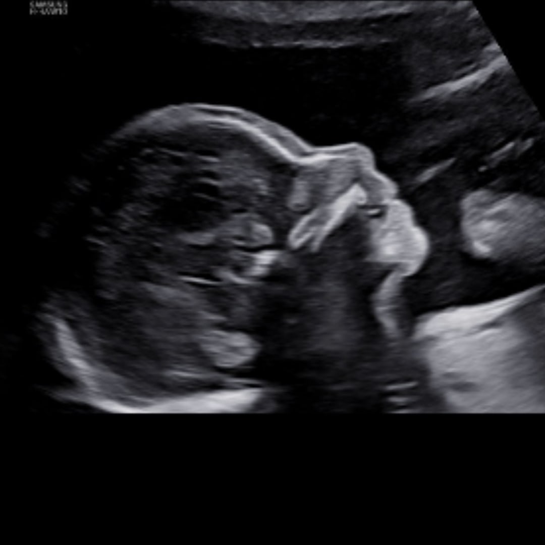 Photo shared by Monique for their Babylist baby registry.