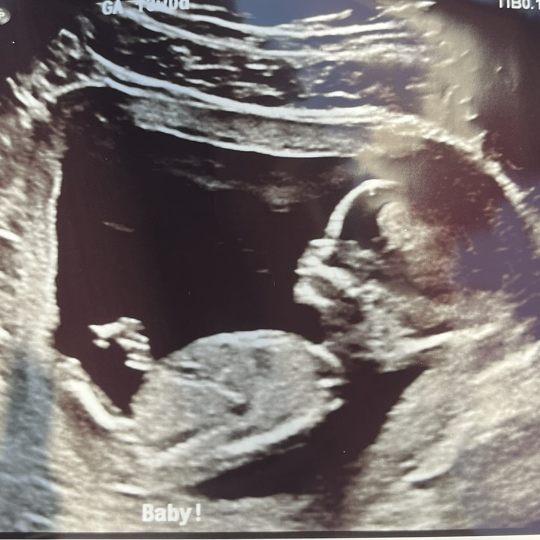 Photo shared by Alyssa for their Babylist baby registry.