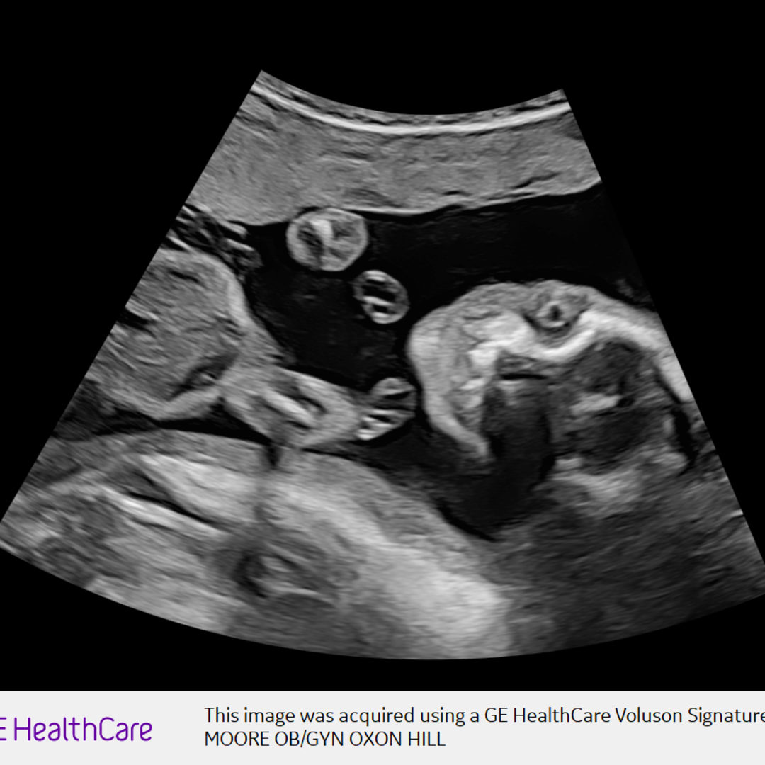 Photo shared by Jonice for their Babylist baby registry.