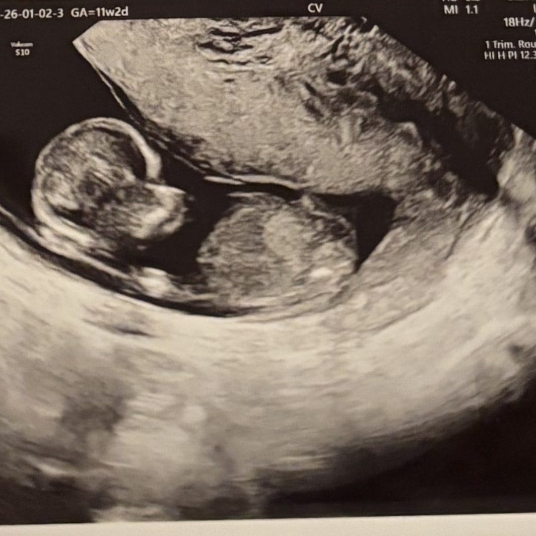 Photo shared by Sarah for their Babylist baby registry.