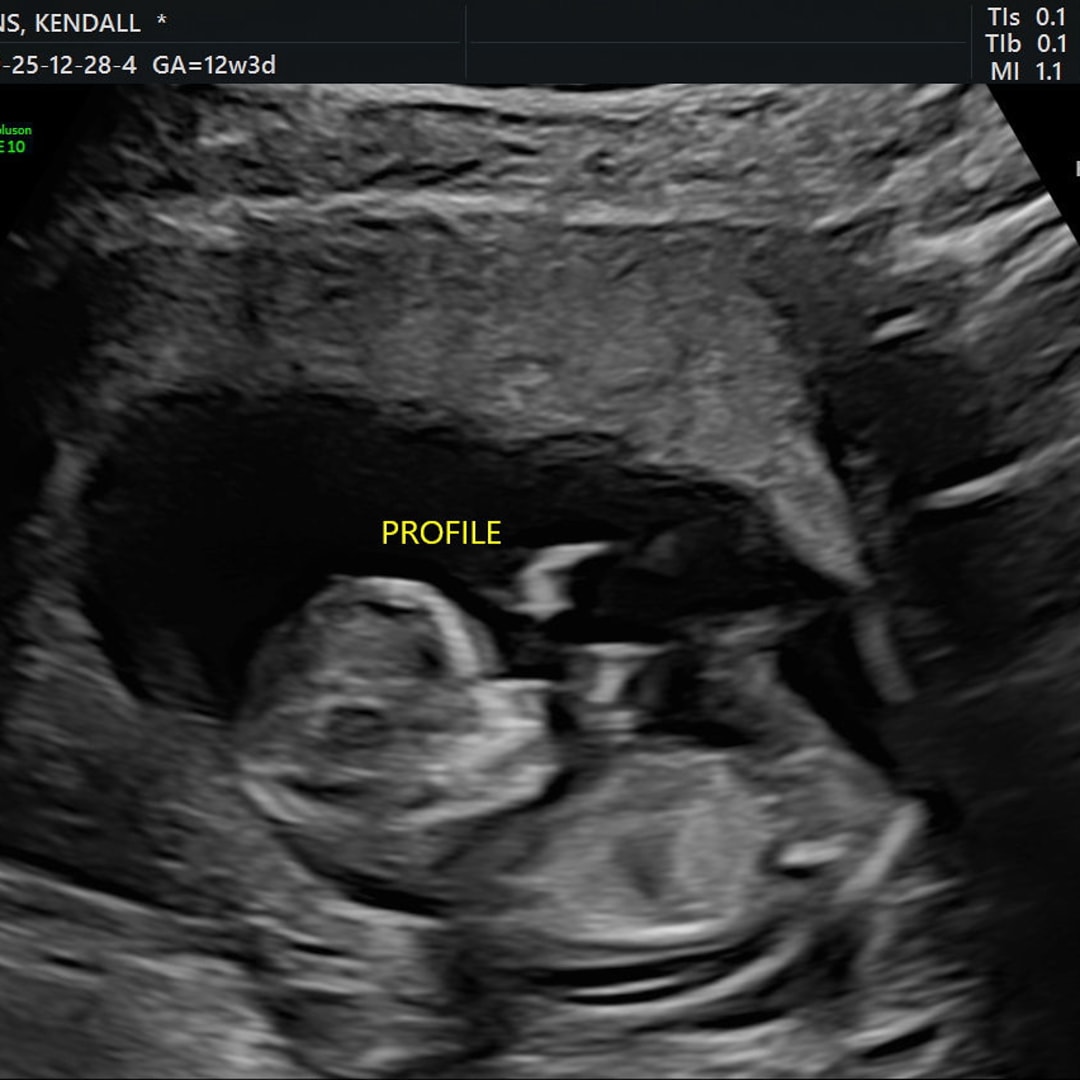 Photo shared by Kendall and Aj for their Babylist baby registry.